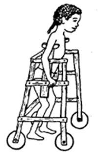 Rent Crutches and Walker, Crutches Walker On Rent in Delhi on rent in Mumbai, India